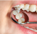 כתרים וציפויים: כל מה שצריך לדעת על טיפולי שיקום ואסתטיקת השיניים  -תמונה